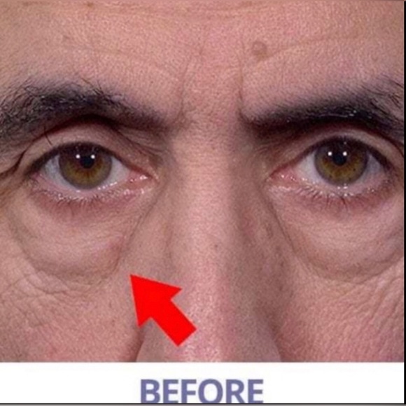Fast Acting Eye Serum, Tint & Tighten (5) - Picture 6 of 15